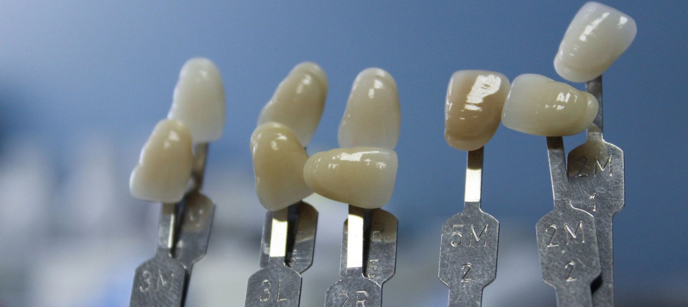 Máster en Prótesis, Implantoprótesis y Estética Dental